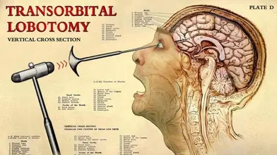 Headshrinkers Part 2
